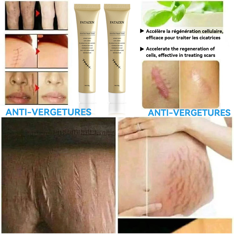 Scar Cream - Acne Mark Redness Reduction