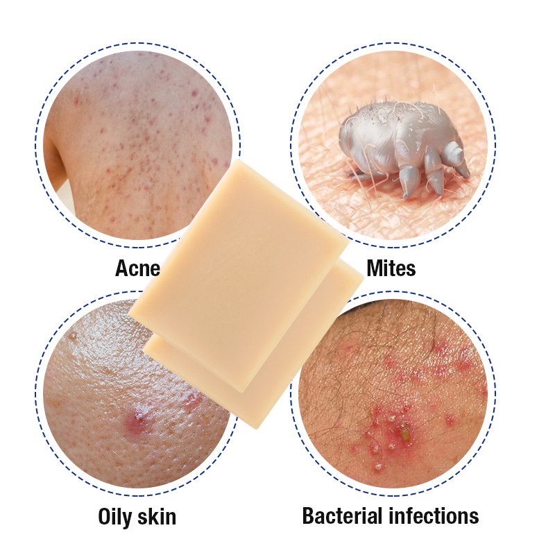 Hair Soap - Batana Oil Scalp Repair