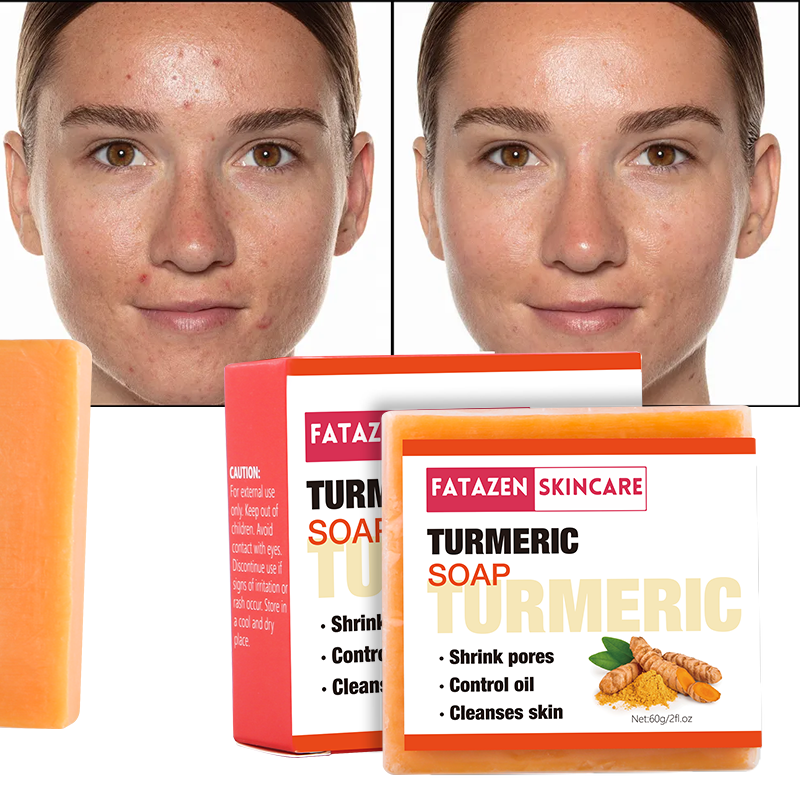 Toilet Soap - Deep Cleansing Anti Acne