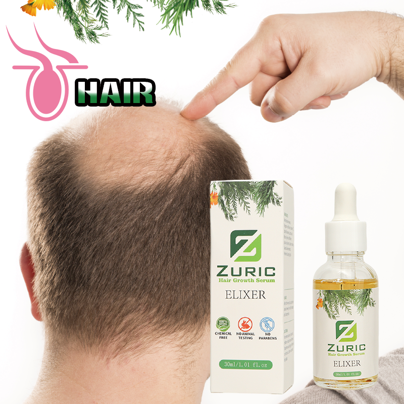 Hair Growth Oil - Rosemary Coconut Scalp Care