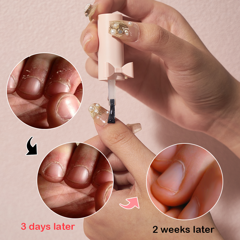 Nail Treatment Oil - Growth Care Formula