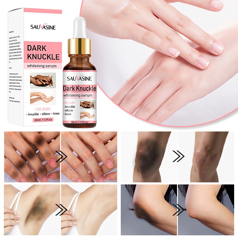 Hand Serum - Vitamin E Dark Knuckles Whitening