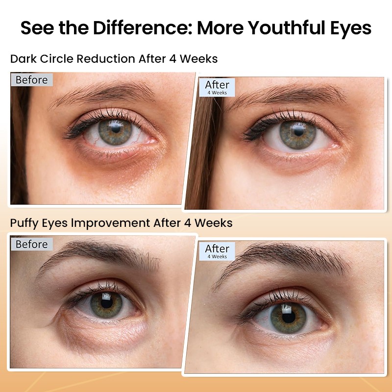 Eye Cream - Coffee Retinol Dark Circle