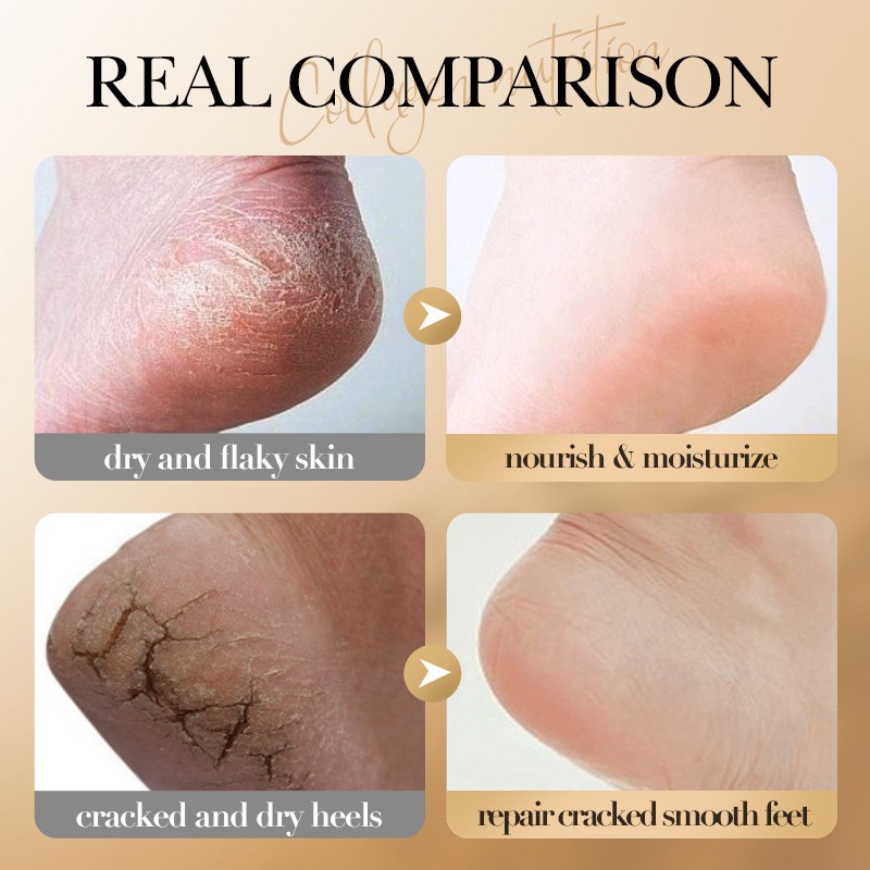 Foot Cream - Collagen Hyaluronic Acid Crack Treatment