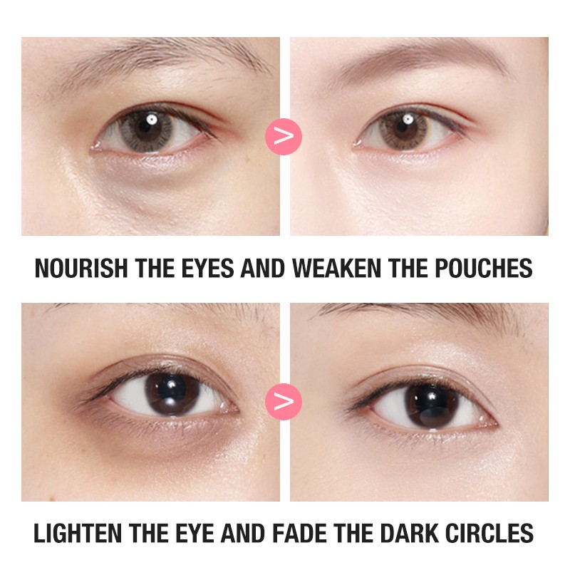 Eye Patches - Vitamin E Honey Peach Brightening