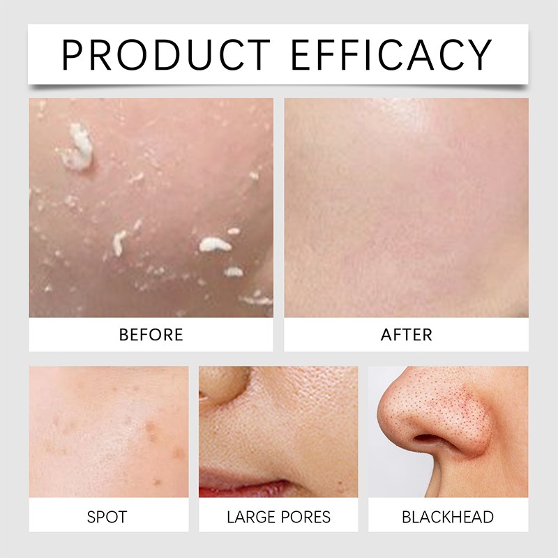 Men's Skincare Set - Glycerin Hyaluronic Acid Dry Skin