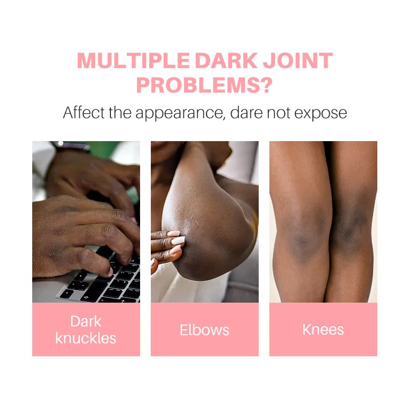 Hand Serum - Vitamin E Dark Knuckles Whitening