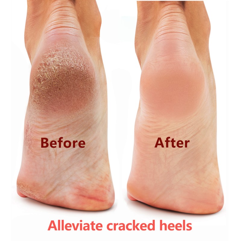 Foot Cream - Horse Oil Moisturizing Massager