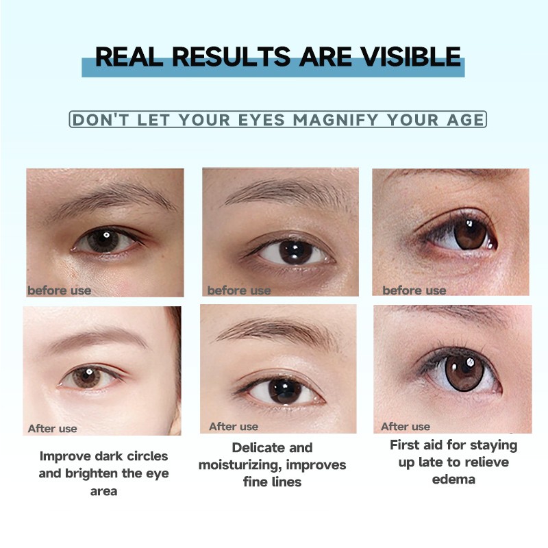 Eye Patches 60pcs - Retinol Collagen Puffiness Care