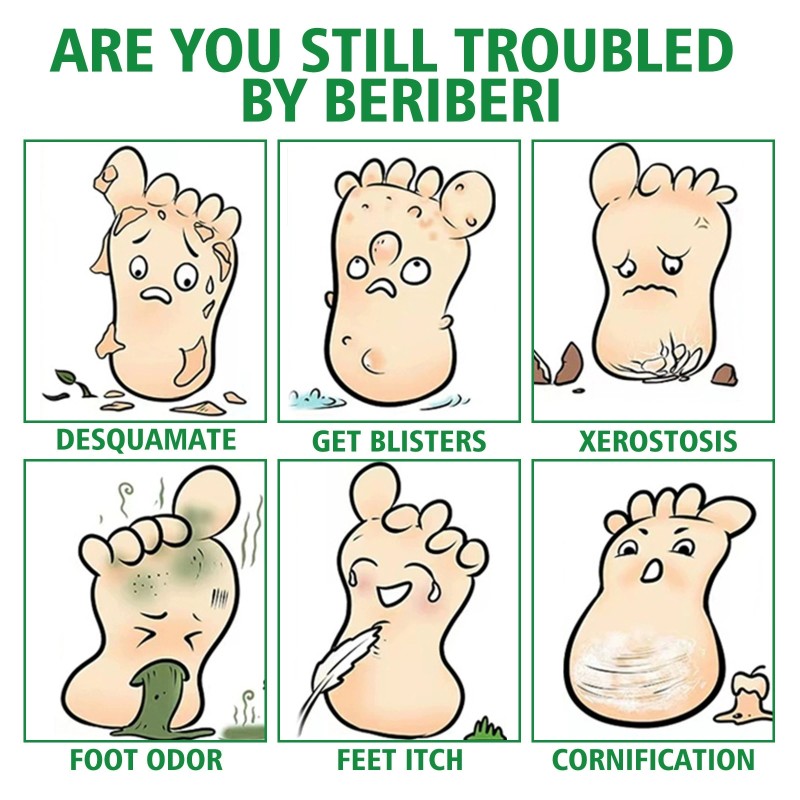 Foot Spray 30ml - Antifungal Treatment Formula