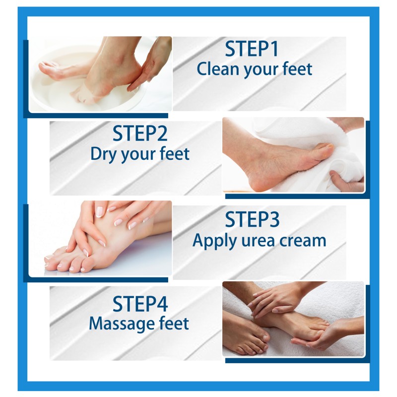 Urea Cream 40% - Salicylic Acid Callus Remover