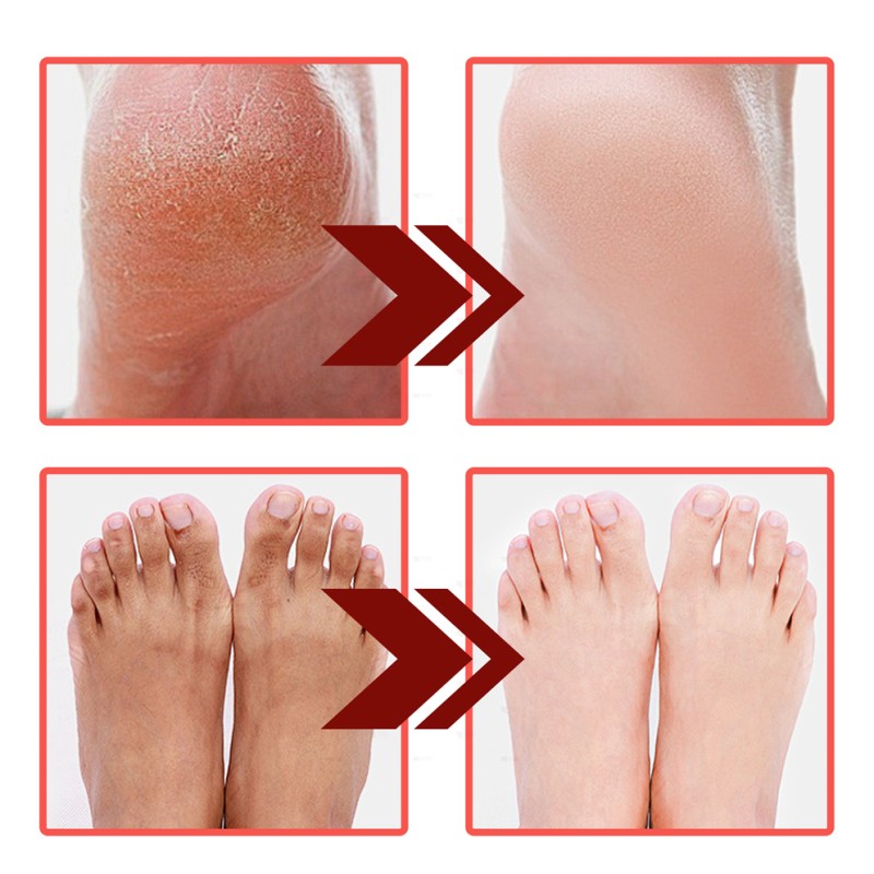 Foot Cream - Horse Oil Moisturizing Massager