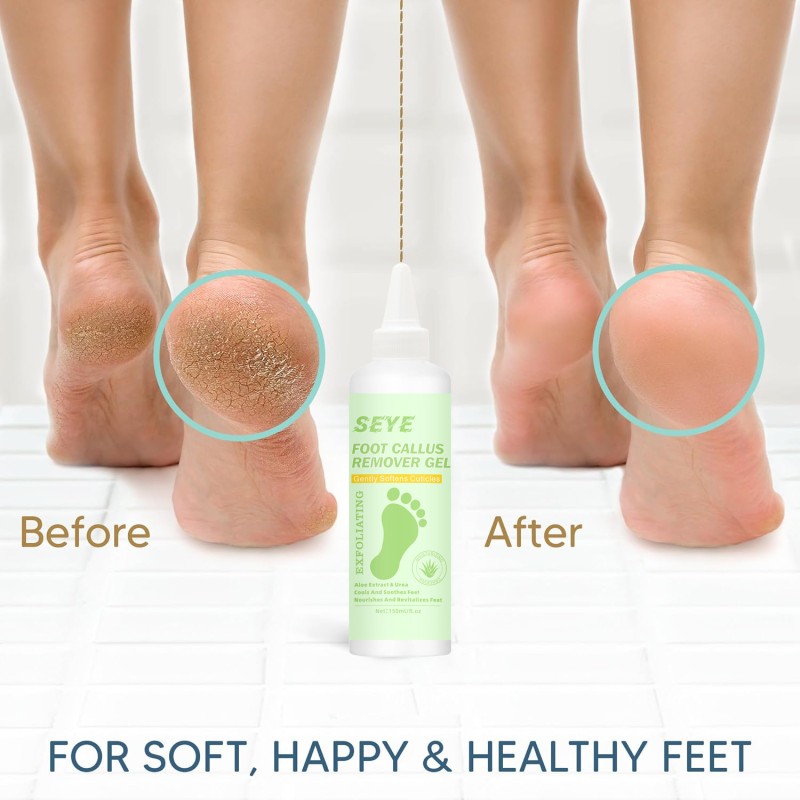 Foot Gel 6oz - Herbal Callus Remover Pedicure
