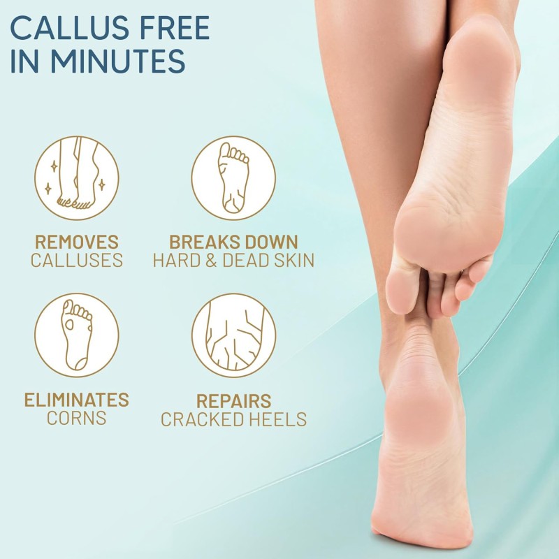 Foot Gel 6oz - Herbal Callus Remover Pedicure