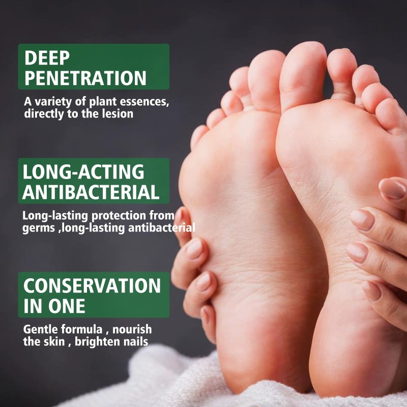 Foot Spray 30ml - Antifungal Herbal Treatment