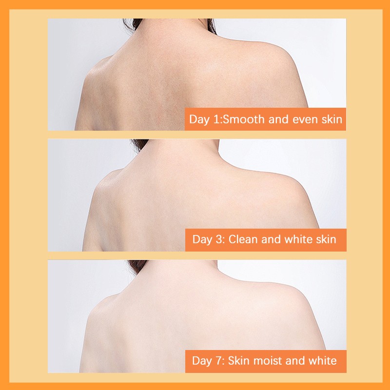 Face Scrub - Sugar Turmeric Acne Scar Reduction