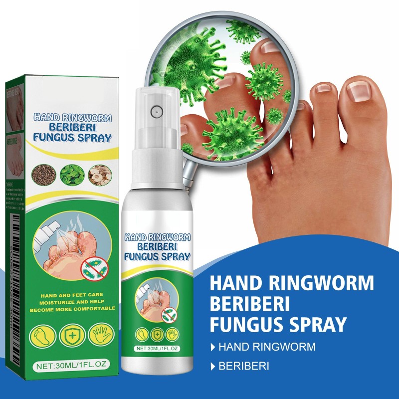 Foot Spray 30ml - Antifungal Herbal Treatment