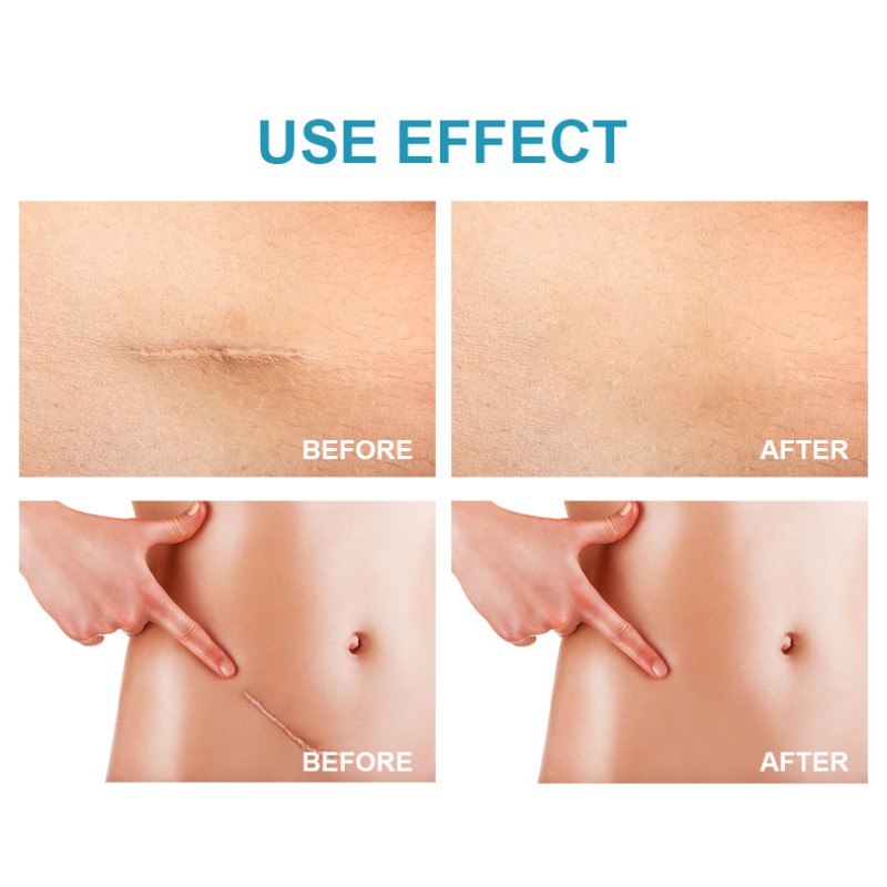 Baby Sunscreen - Aloe Green Tea SPF50