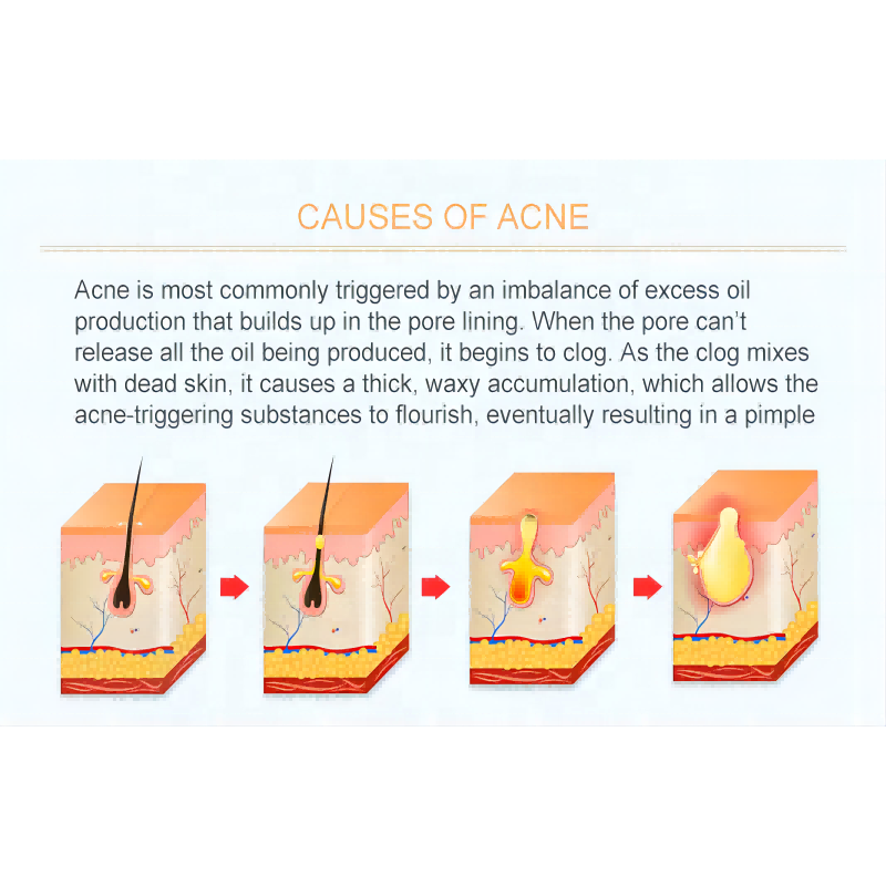 Lip Care Set - Honey Sakura Overnight Balm