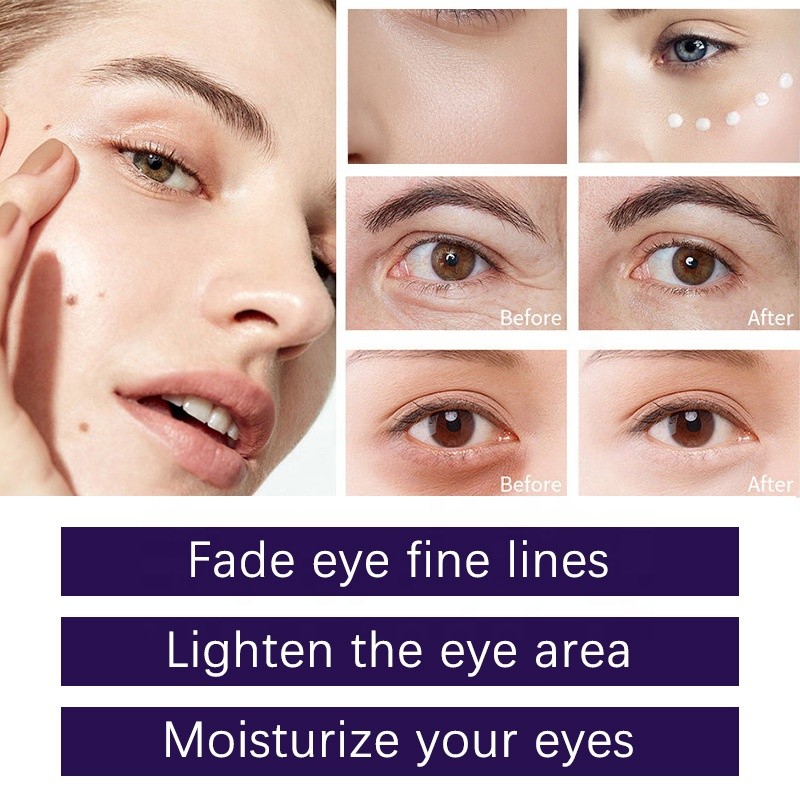 Eye Cream - Retinol Wrinkle Reduction Moisturizer