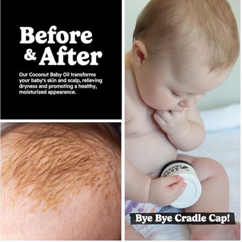 Baby Oil - Alcohol Free Rash Relief