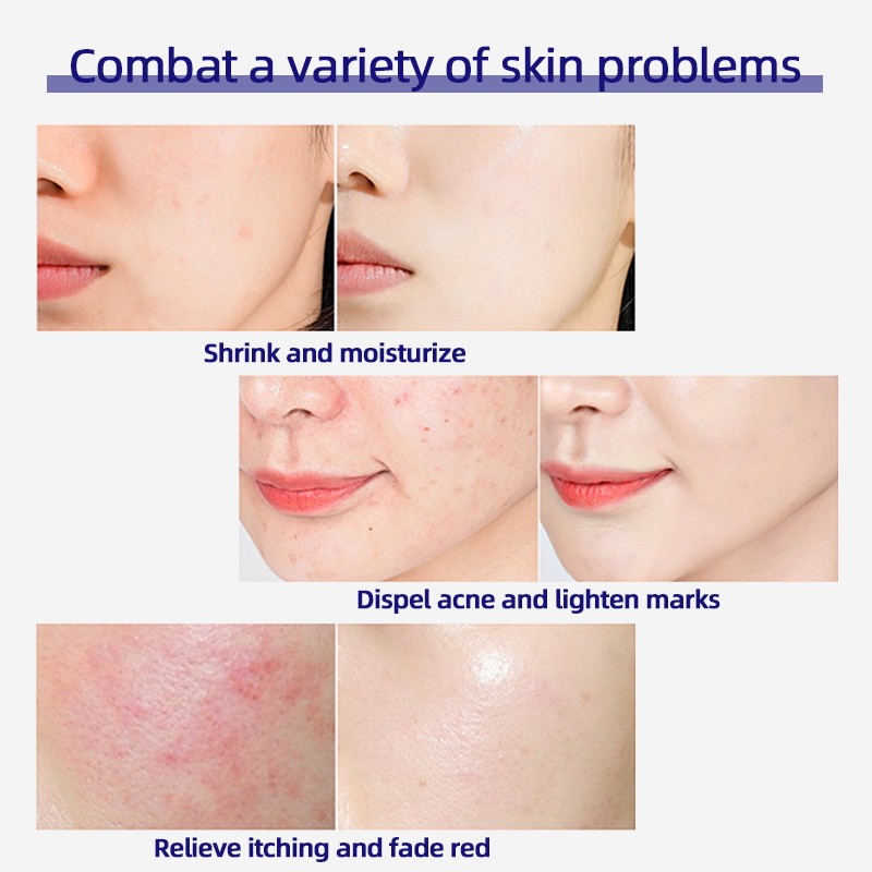 Freeze-dried Powder - Bose Anti Wrinkle Restoring