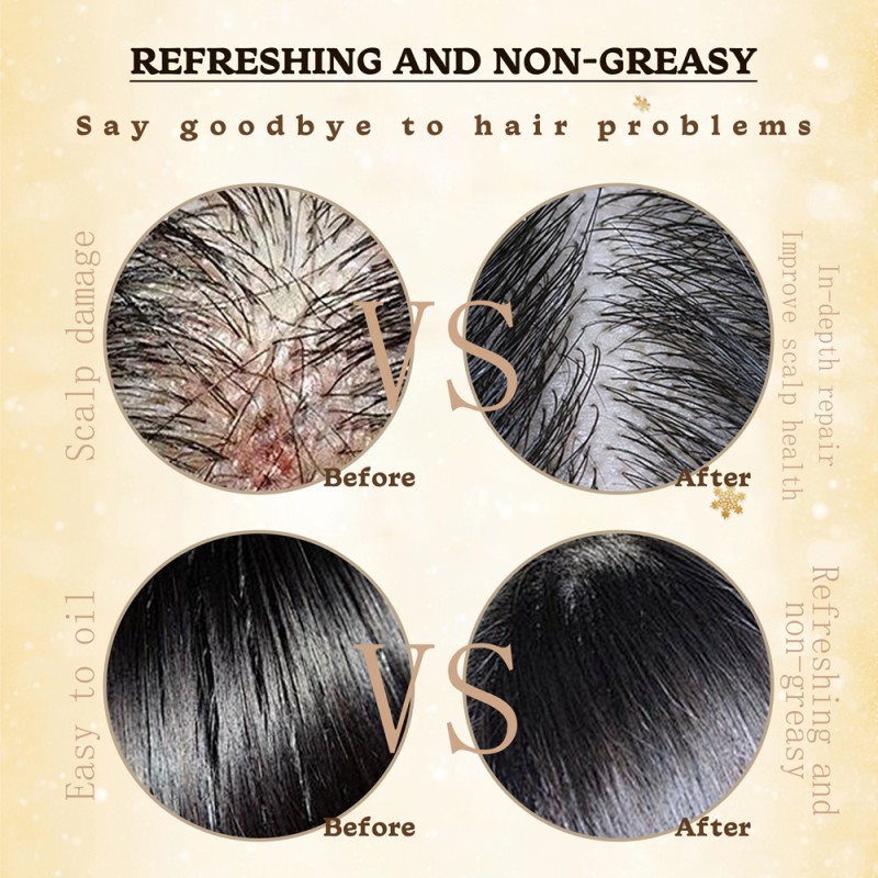 Shampoo - Dead Sea Salt Anti Dandruff Scalp