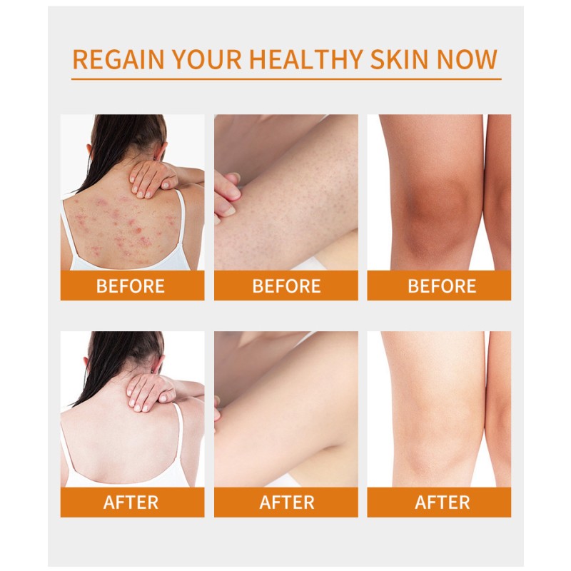 Skin Cream 50ml - Vitamin B5 Repair Moisturizing