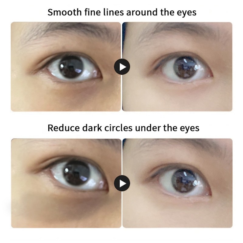 Silicone Eye Mask - OEM Washable Wrinkle Pads