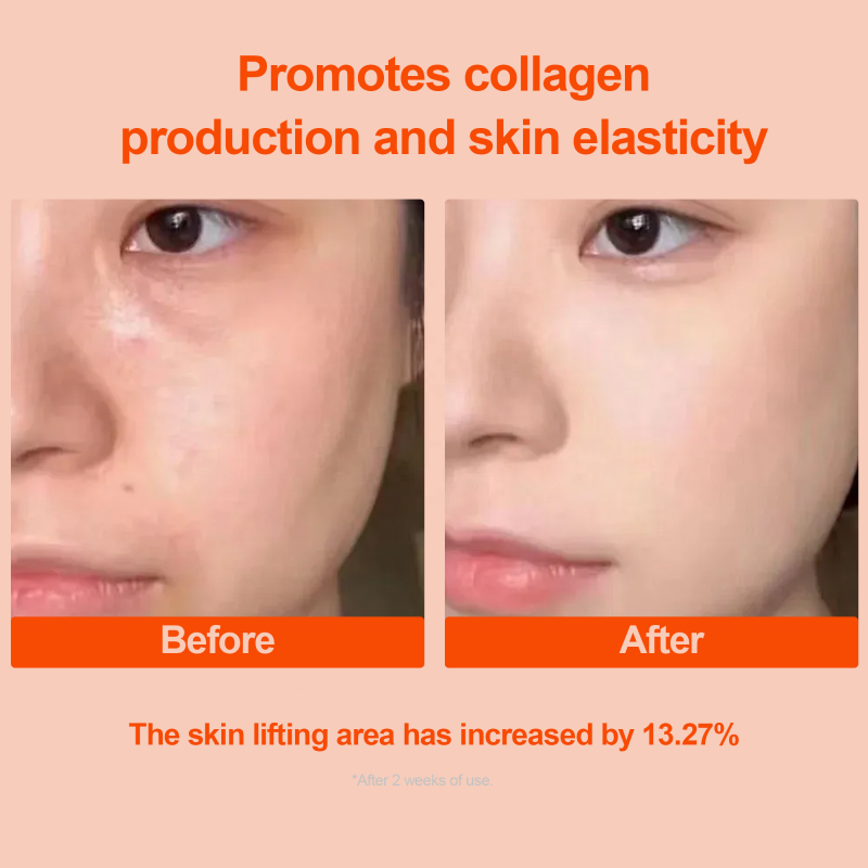 Ectoin Serum - Wholesale Probiotic Firming Rejuvenation