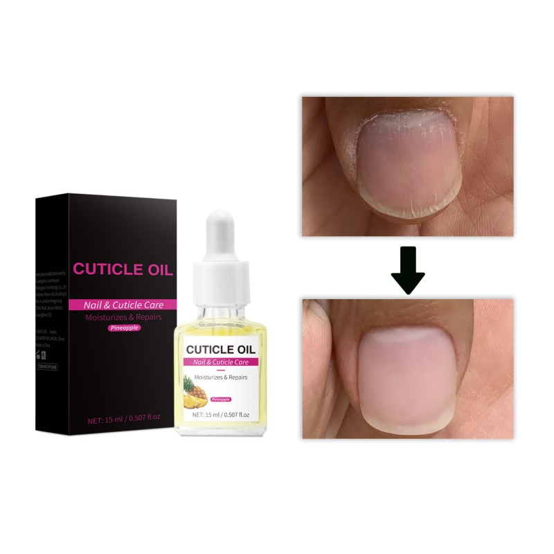 Wart Care Solution 20ml - Bee Venom Keratosis