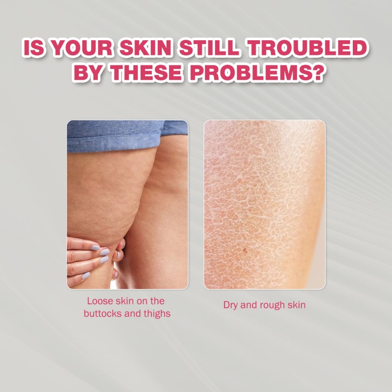 Wart Care Spray 20ml - Bee Venom Glycolic Acid