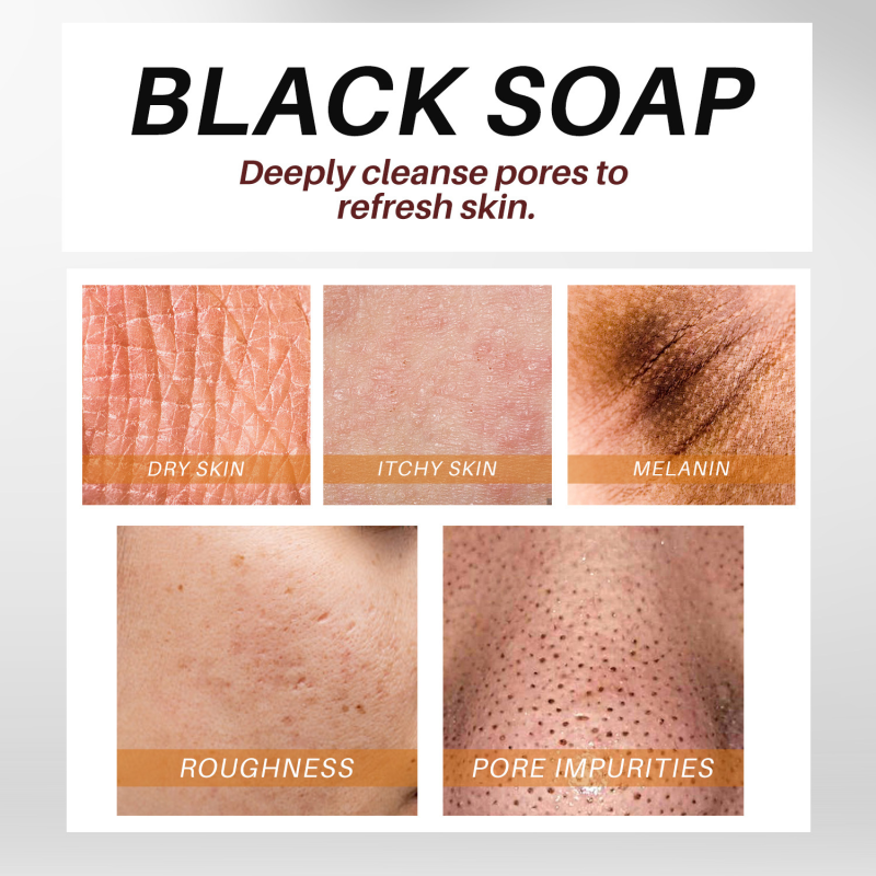 Forehead Patches 12pcs - Anti Wrinkle Moisturizing