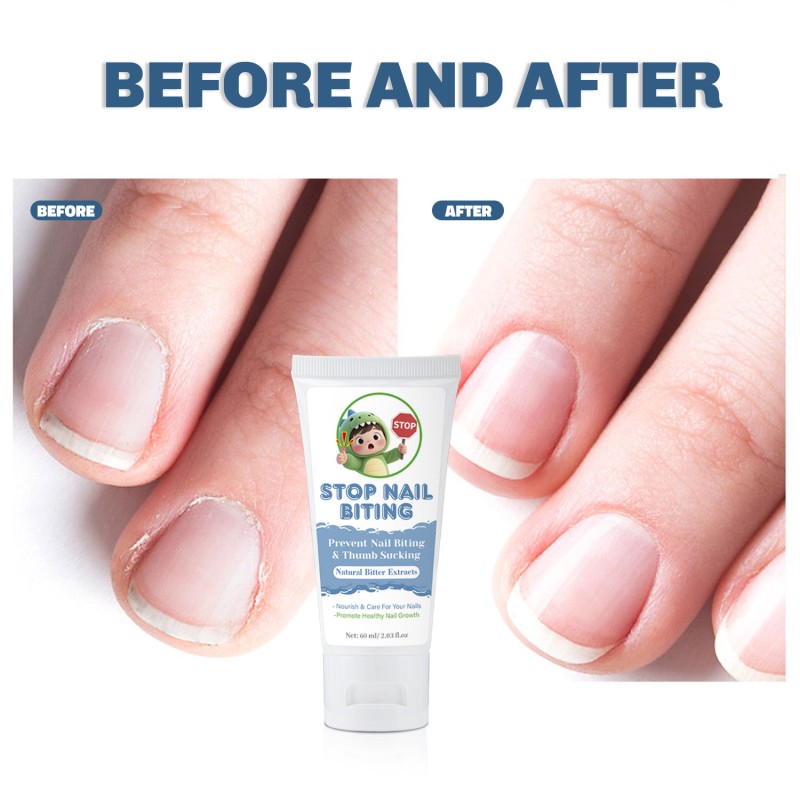 Baby Nail Liquid 30ml - Safe Anti Biting Formula