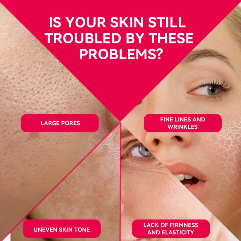 Face Toner 120ml - Niacinamide Vitamin C Oil Control