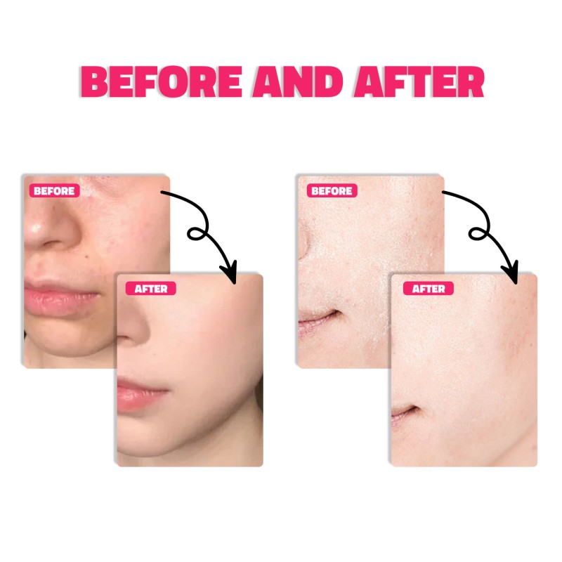 White Truffle Serum - Luxury Anti Aging Brightening