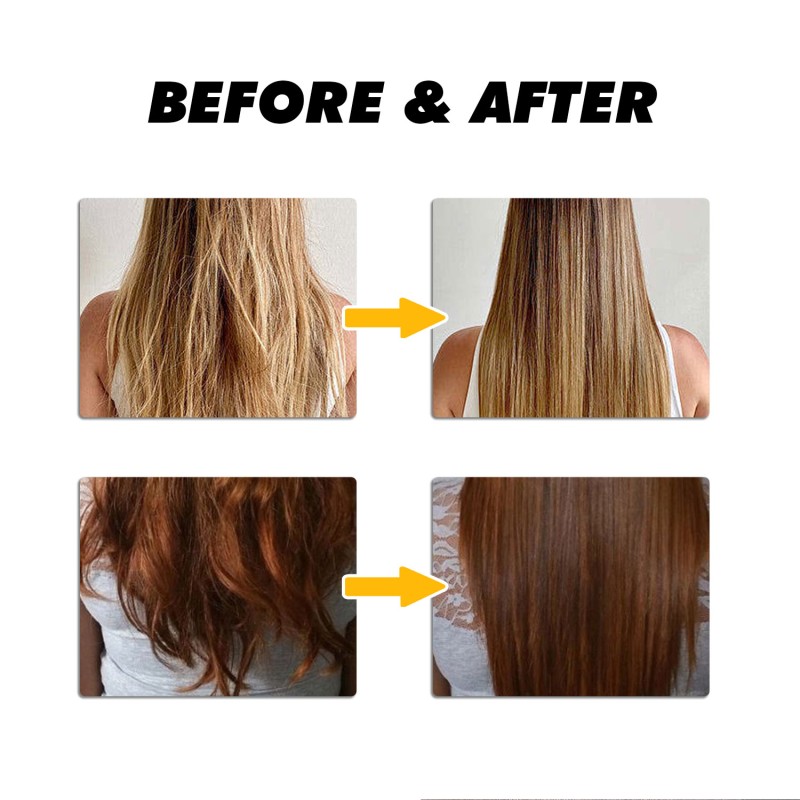 Scalp Serum 20g - Niacinamide Salicylic Acid