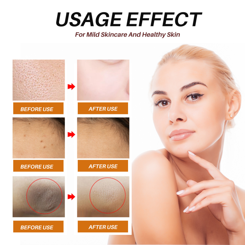 Forehead Patches 12pcs - Anti Wrinkle Moisturizing