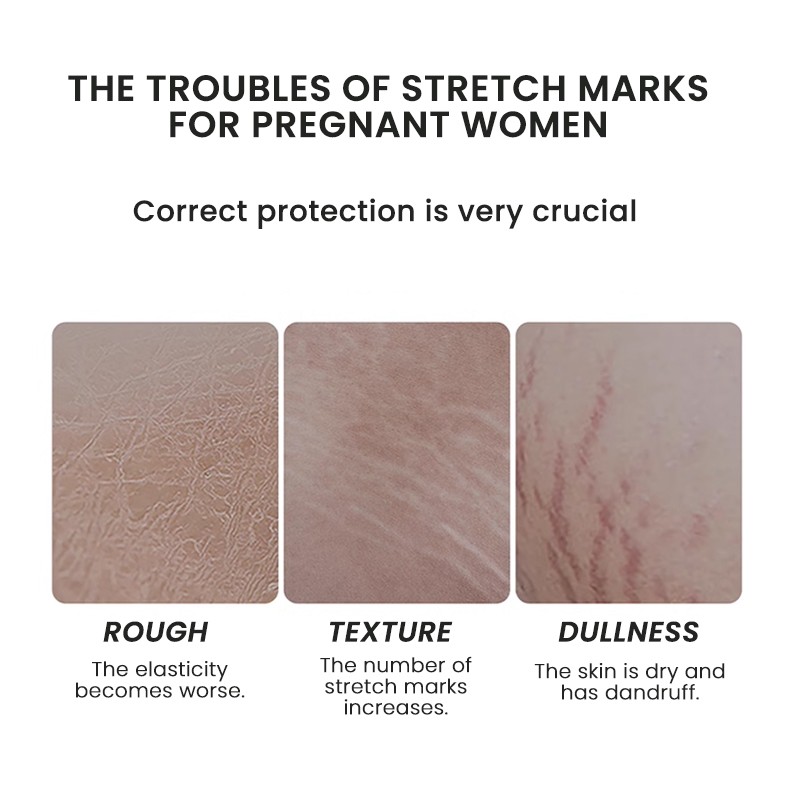 Anti Stretch Marks Oil Factory - MULAN Organic Nourishing Smooth Honey