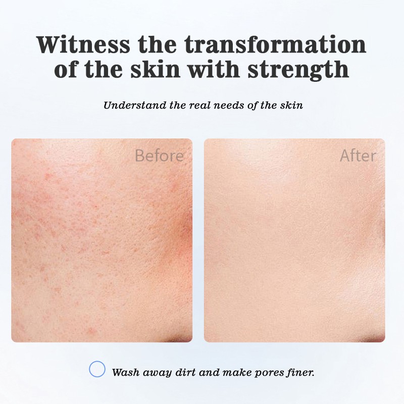 Facial Cleanser Manufacturer - MULAN Vegan Niacinamide Amino Acid Deep