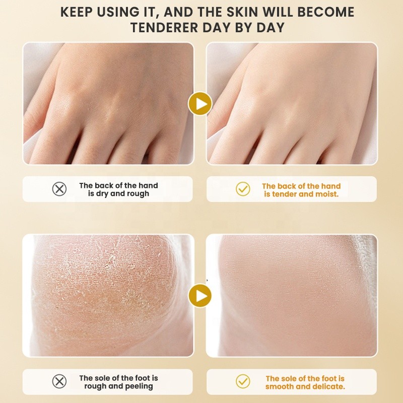 Hand Foot Cream Factory - MULAN Anti Cracking Moisturizing Whitening