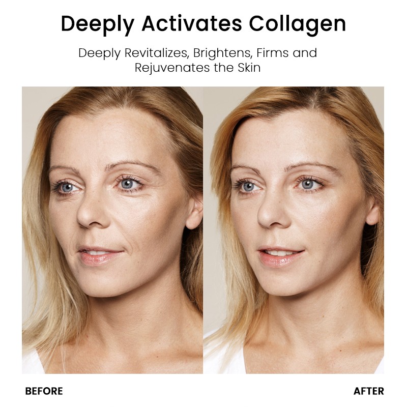 Anti Aging Cream Manufacturer - MULAN Retinol Wrinkle Collagen Fine Lines