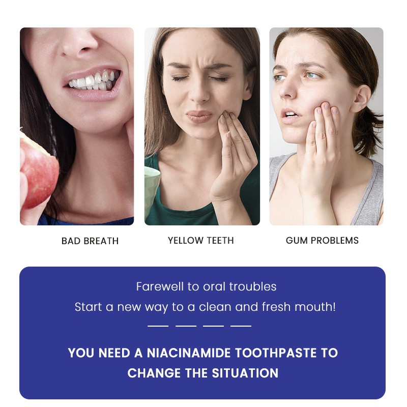 Toothpaste Manufacturer - MULAN Private Label Niacinamide Herbal