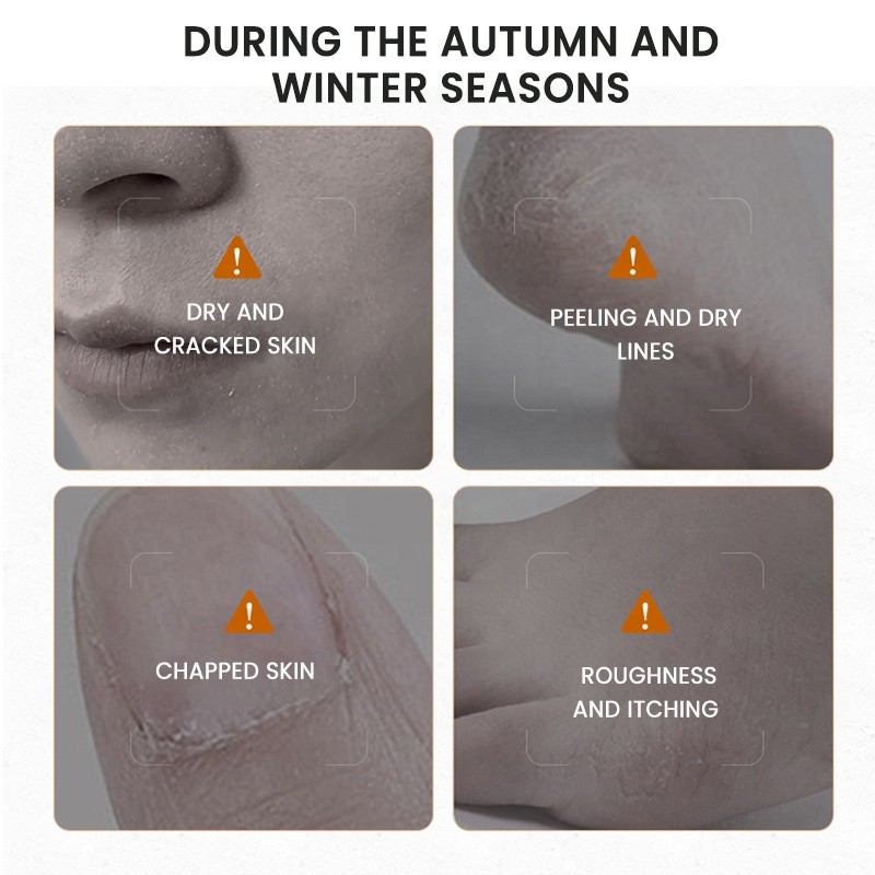 Hand Foot Cream Factory - MULAN Anti Cracking Moisturizing Whitening