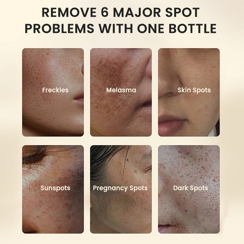 Skin Care Toner Manufacturer - MULAN OEM Private Label Whitening Antioxidant