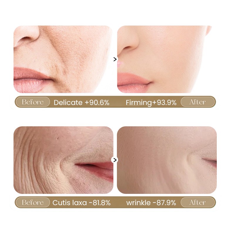 Whitening Face Cream Factory - MULAN Women 30ml Glycerin Antioxidant