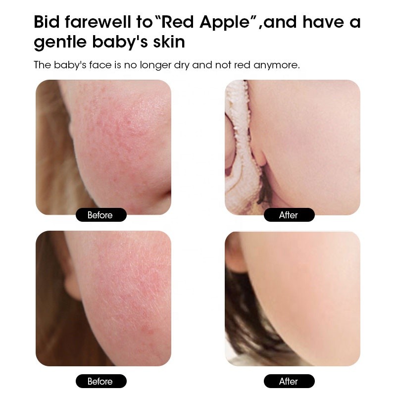 Baby Care Cream Manufacturer - MULAN Original Calendula Extra Moisturizing