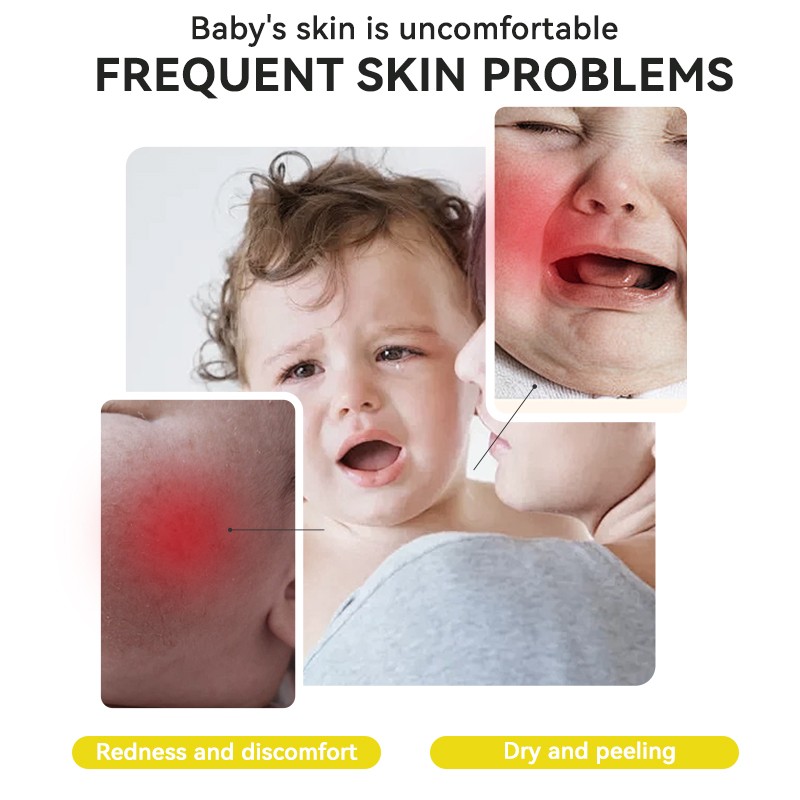 Baby Skin Care Manufacturer - MULAN Organic Natural Tea Seed