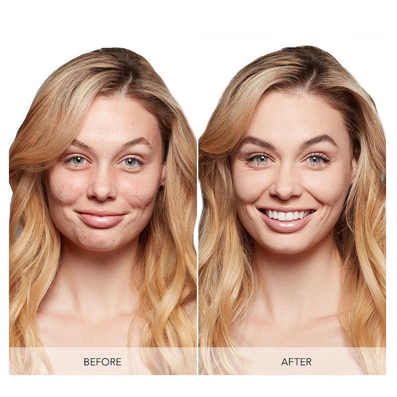 Repair Face Cream Manufacturer - MULAN Hyaluronic Acid Herbal Glycerin