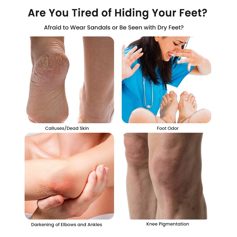 Foot Scrub Factory - MULAN Exfoliating Cream Pedicure Callus Dissolving